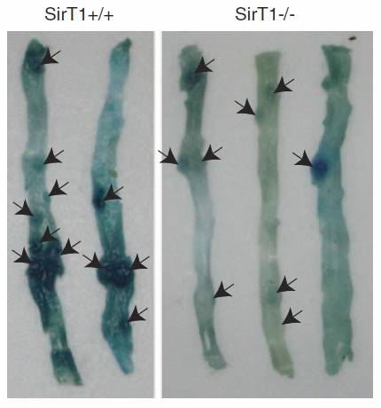 Intestinal polyp load for mice: comparison