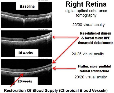 Retina - tomography