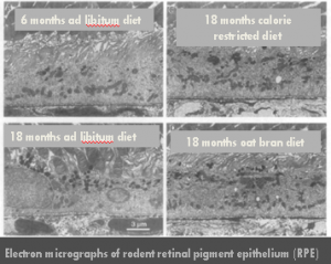 Electron Micrographs of rodent retinal pigment epithelium