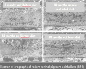 Electron Micrographs of Rodent Retinal Pigment Epithelium